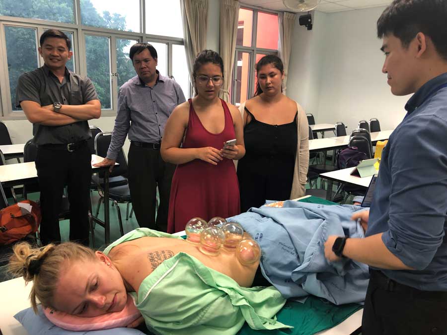 A women laying face down on a table with cupping on her back and five people observing the demonstration.